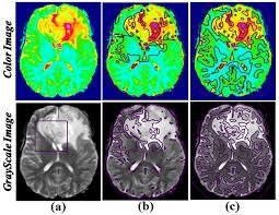 image segmentation